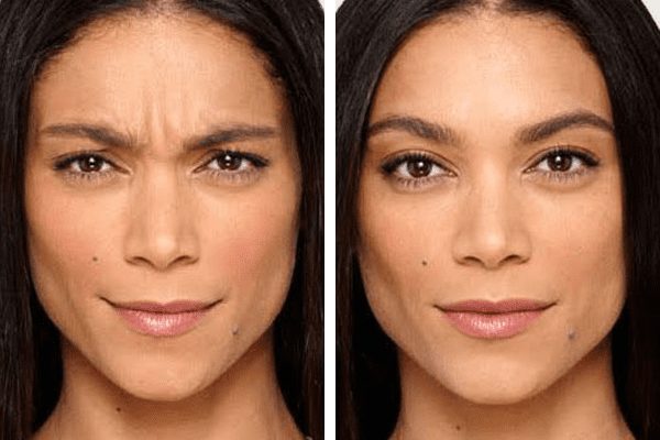 antiageinginjections