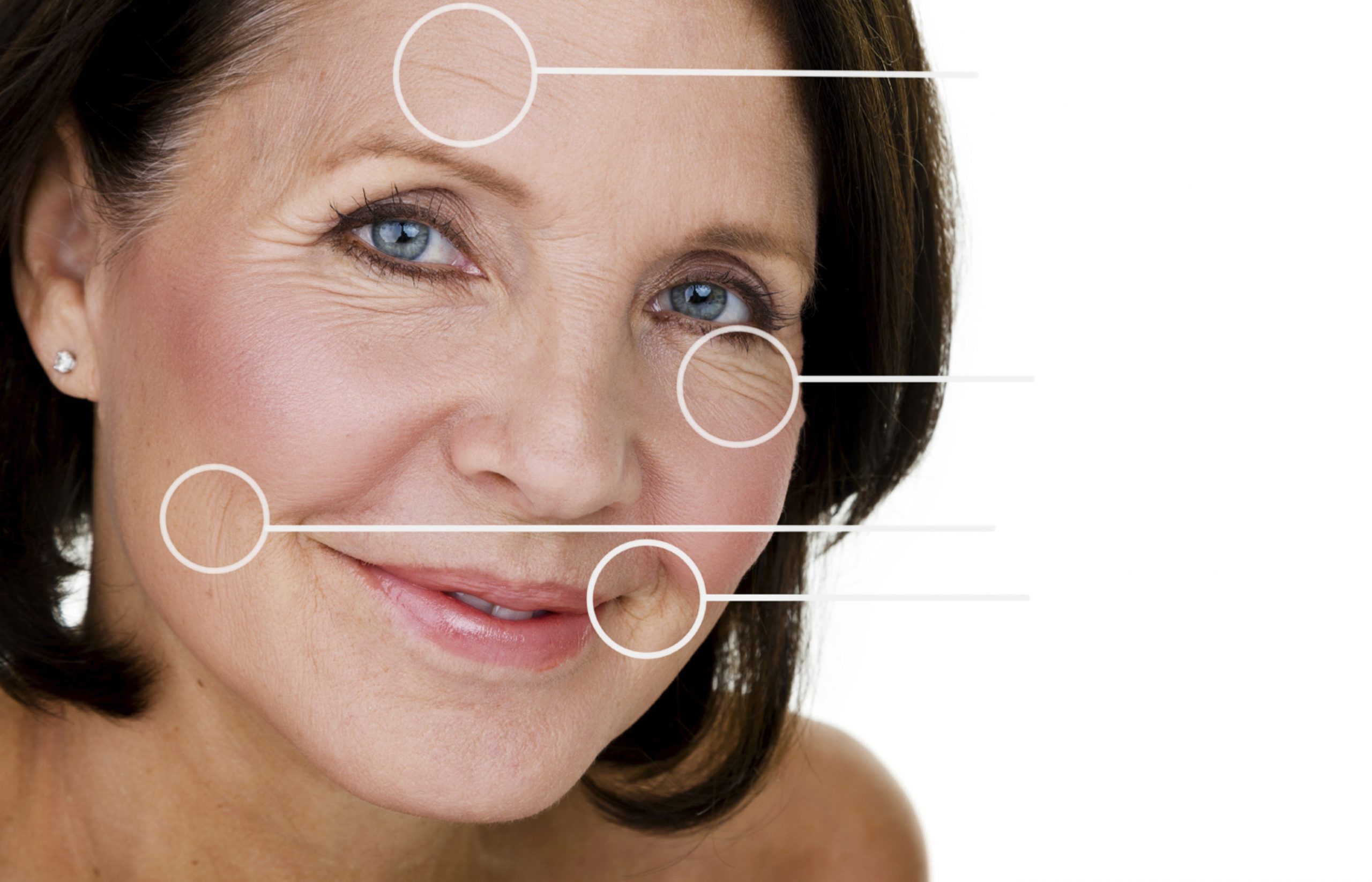 Pellevé Skin Tightening