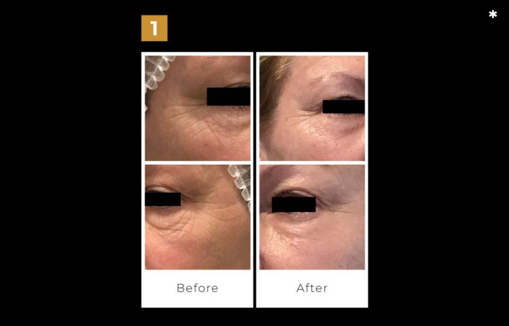 PlasmaPen 1024x657 1