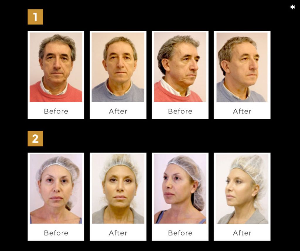 Sillhouette 1024x857 1