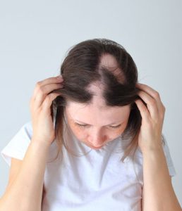 laserhairloss